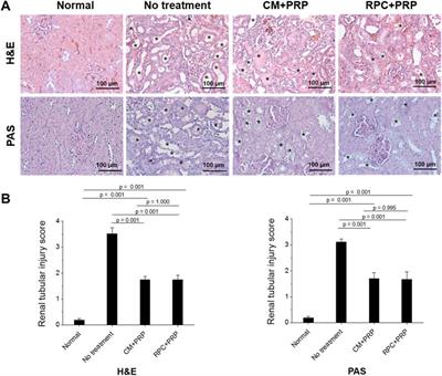 The Delivery of the Recombinant Protein Cocktail Identified by Stem Cell-Derived Secretome Analysis Accelerates Kidney Repair After Renal Ischemia-Reperfusion Injury